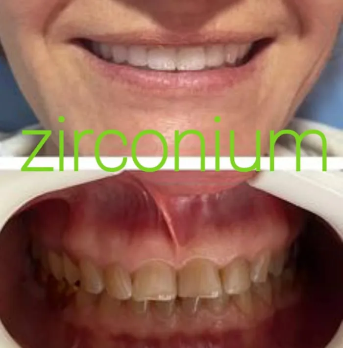 Alanya HEALTHY TEETH Dental Aesthetic — Медицина в Аланье: Онлайн-заказ, цены и отзывы