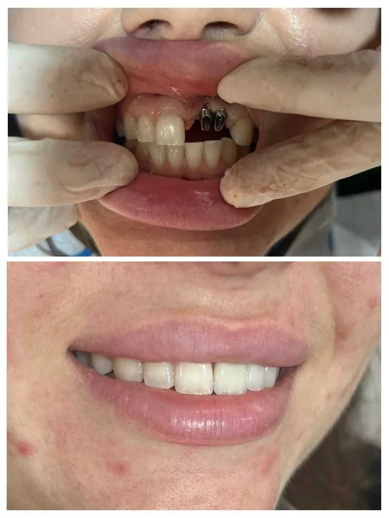 Alanya HEALTHY TEETH Dental Aesthetic — Медицина в Аланье: Онлайн-заказ, цены и отзывы