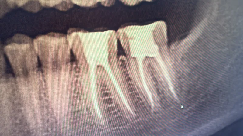 Alanya HEALTHY TEETH Dental Aesthetic — Медицина в Аланье: Онлайн-заказ, цены и отзывы